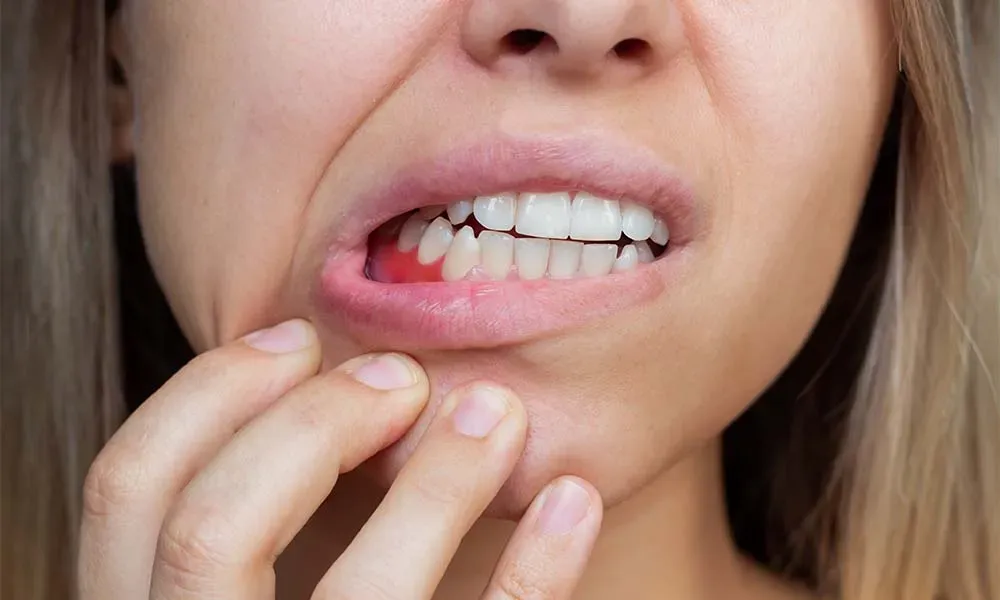 how long does a cut gum take to heal