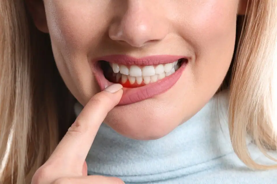 how long does it take gums to heal from a cut