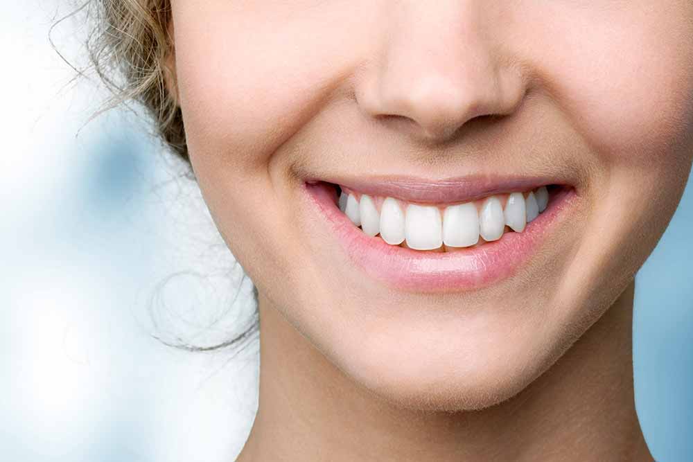 how to reduce gap between teeth naturally