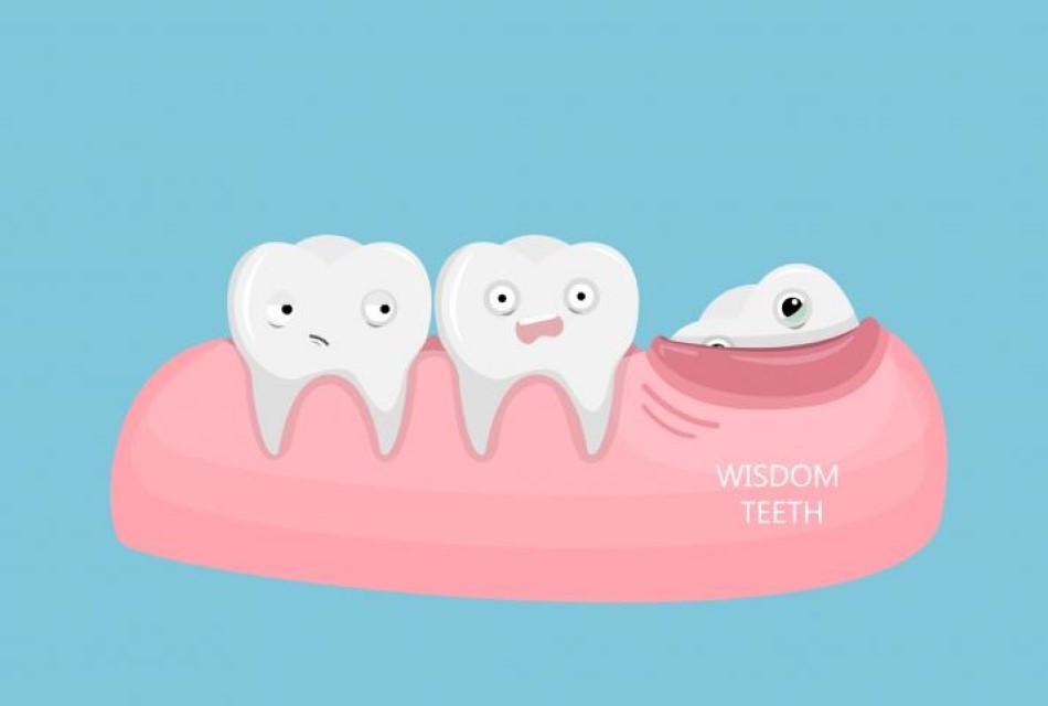 why are they called wisdom teeth
